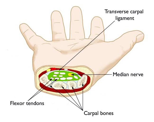 A cross section of the anatomic area known as the carpal tunnel compartment